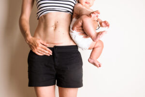 woman with c-section scar holding her baby.